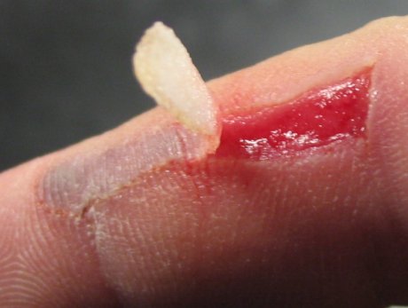 Flappy, the Waterslide Wound