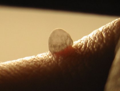 What is it?