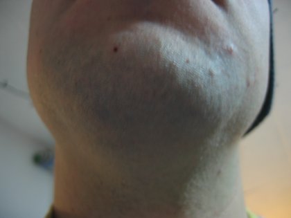 No Beard