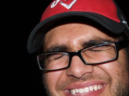 Doesn't Mark have white teeth?
