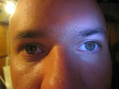 Wierd eyes