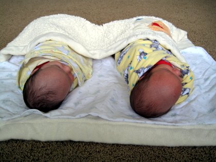 Babies going bald