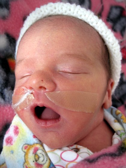 VAF Fast Asleep