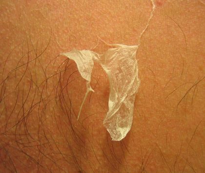 I'm Peeling